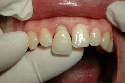 CROAZIA DENTISTI VANTAGGIOSI.............