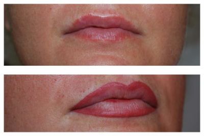 Corso Micropigmentazione Estetica